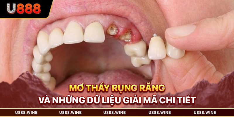 Mơ thấy rụng răng